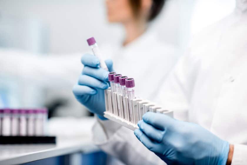 lab testing